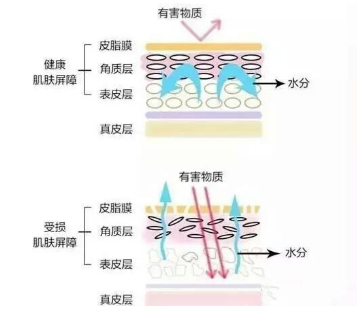 干、癢、紅、腫？別慌涂護膚品，先看看皮膚屏